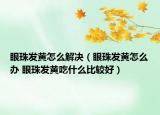 眼珠發(fā)黃怎么解決（眼珠發(fā)黃怎么辦 眼珠發(fā)黃吃什么比較好）