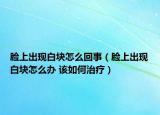 臉上出現(xiàn)白塊怎么回事（臉上出現(xiàn)白塊怎么辦 該如何治療）