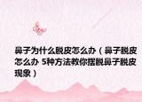 鼻子為什么脫皮怎么辦（鼻子脫皮怎么辦 5種方法教你擺脫鼻子脫皮現(xiàn)象）