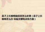 鼻子上長(zhǎng)痤瘡痘應(yīng)該怎么處理（鼻子上長(zhǎng)痤瘡怎么辦 祛痘關(guān)鍵有這些方面）