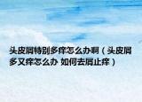 頭皮屑特別多癢怎么辦?。^皮屑多又癢怎么辦 如何去屑止癢）