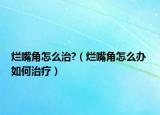 爛嘴角怎么治?（爛嘴角怎么辦 如何治療）