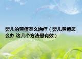 嬰兒的黃疸怎么治療（嬰兒黃疸怎么辦 這幾個(gè)方法最有效）