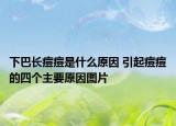 下巴長痘痘是什么原因 引起痘痘的四個主要原因圖片