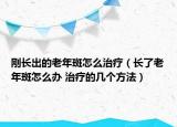剛長(zhǎng)出的老年斑怎么治療（長(zhǎng)了老年斑怎么辦 治療的幾個(gè)方法）