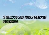 牙縫過(guò)大怎么辦 導(dǎo)致牙縫變大的因素有哪些