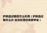 護膚品過敏后怎么處理（護膚品過敏怎么辦 應(yīng)急處理你需要學(xué)會）