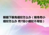 眼睛下眼角細(xì)紋怎么辦（眼角有小細(xì)紋怎么辦 有7招小細(xì)紋不用怕）