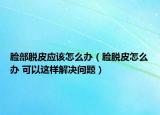 臉部脫皮應(yīng)該怎么辦（臉脫皮怎么辦 可以這樣解決問題）