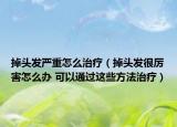 掉頭發(fā)嚴重怎么治療（掉頭發(fā)很厲害怎么辦 可以通過這些方法治療）