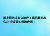 嘴上起泡該怎么治療（嘴巴起泡怎么辦 應(yīng)該要如何治療呢）