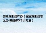 嬰兒屁股紅咋辦（寶寶屁股紅怎么辦 教給你5個(gè)小方法）