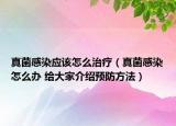 真菌感染應該怎么治療（真菌感染怎么辦 給大家介紹預防方法）