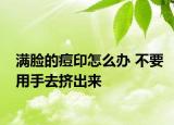 滿臉的痘印怎么辦 不要用手去擠出來