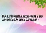 額頭上長(zhǎng)粉刺是什么原因如何去除（額頭上長(zhǎng)粉刺怎么辦 日常怎么護(hù)理皮膚）