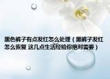 黑色褲子有點(diǎn)發(fā)紅怎么處理（黑褲子發(fā)紅怎么恢復(fù) 這幾點(diǎn)生活經(jīng)驗(yàn)?zāi)憬^對(duì)需要）