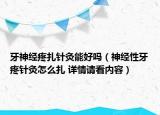 牙神經(jīng)疼扎針灸能好嗎（神經(jīng)性牙疼針灸怎么扎 詳情請(qǐng)看內(nèi)容）