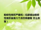 粉碎性骨折嚴(yán)重嗎（右膝鏡臺(tái)粉碎性骨折直骨六個(gè)月怎樣康復(fù) 怎么恢復(fù)）