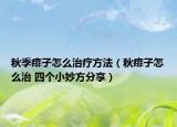秋季痱子怎么治療方法（秋痱子怎么治 四個(gè)小妙方分享）