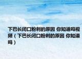 下巴長(zhǎng)閉口粉刺的原因 你知道嗎視頻（下巴長(zhǎng)閉口粉刺的原因 你知道嗎）