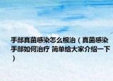 手部真菌感染怎么根治（真菌感染手部如何治療 簡(jiǎn)單給大家介紹一下）