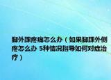 腳外踝疼痛怎么辦（如果腳踝外側(cè)疼怎么辦 5種情況指導(dǎo)如何對癥治療）