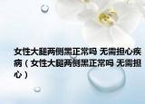 女性大腿兩側(cè)黑正常嗎 無需擔心疾?。ㄅ源笸葍蓚?cè)黑正常嗎 無需擔心）
