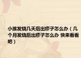 小孩發(fā)燒幾天后出疹子怎么辦（幾個(gè)月發(fā)燒后出疹子怎么辦 快來看看吧）