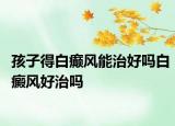 孩子得白癲風能治好嗎白癜風好治嗎
