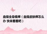 血燥全身瘙癢（血燥皮膚癢怎么辦 快來看看吧）