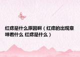 紅痣是什么原因?。t痣的出現(xiàn)意味著什么 紅痣是什么）