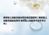 腸系膜上動(dòng)脈夾層治愈后有后遺癥嗎（腸系膜上動(dòng)脈夾層能自愈嗎 腸系膜上動(dòng)脈夾不動(dòng)手術(shù)行嗎）