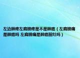 左邊肺疼左肩膀疼是不是肺癌（左肩膀痛是肺癌嗎 左肩膀痛是肺癌前灶嗎）