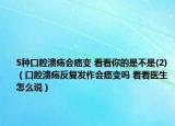 5種口腔潰瘍會(huì)癌變 看看你的是不是(2)（口腔潰瘍反復(fù)發(fā)作會(huì)癌變嗎 看看醫(yī)生怎么說）