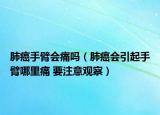 肺癌手臂會痛嗎（肺癌會引起手臂哪里痛 要注意觀察）