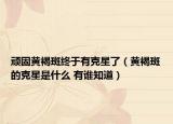 頑固黃褐斑終于有克星了（黃褐斑的克星是什么 有誰知道）