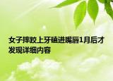 女子摔跤上牙磕進(jìn)嘴唇1月后才發(fā)現(xiàn)詳細(xì)內(nèi)容