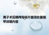 男子術(shù)后曬顱骨碎片最薄處像指甲詳細(xì)內(nèi)容