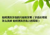 如何清洗牙齒的污垢和牙黃（牙齒長霉斑怎么洗掉 如何清洗牙齒上的霉斑）