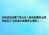 白色皮衣變黃了怎么辦（皮衣發(fā)黃怎么清洗變白了 白色皮衣發(fā)黃怎么清洗）