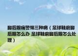 腳后跟痛警惕三種?。ㄗ闱蛐ツ_后跟怎么辦 足球鞋磨腳后跟怎么處理）