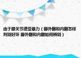由于膝關節(jié)遭受暴力（腳外翻和內翻怎樣判別好壞 腳外翻和內翻如何辨別）