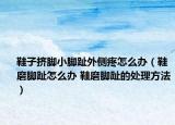 鞋子擠腳小腳趾外側(cè)疼怎么辦（鞋磨腳趾怎么辦 鞋磨腳趾的處理方法）